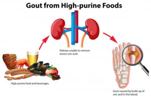 7 Day Indian Diet Plan For High Uric Acid And Gout (What To Eat And